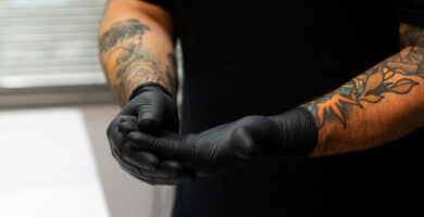 Cirugía y dermoabrasión eliminar tatuaje