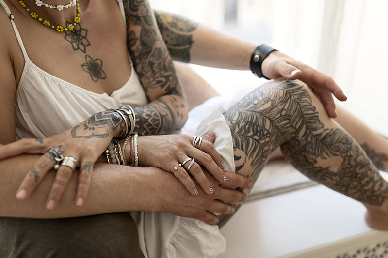 Precio eliminación tatuaje zona corporal