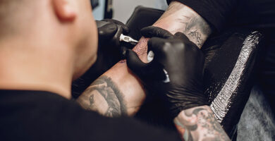 Precio tamaño eliminar tatuaje